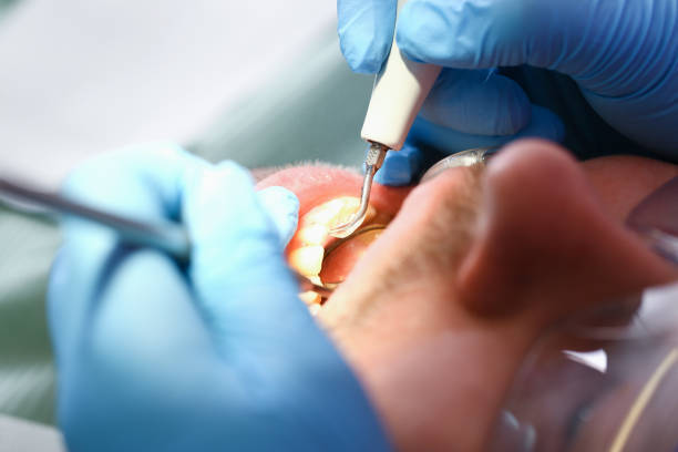 Best Emergency Dental Care for Abscessed Tooth in Pine Ridge, SD